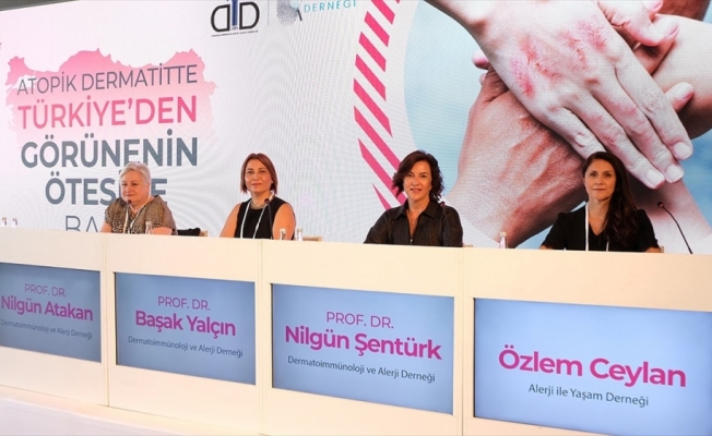 Türkiye'de ilk kez yapılan 'atopik dermatit' araştırmasının sonuçları paylaşıldı